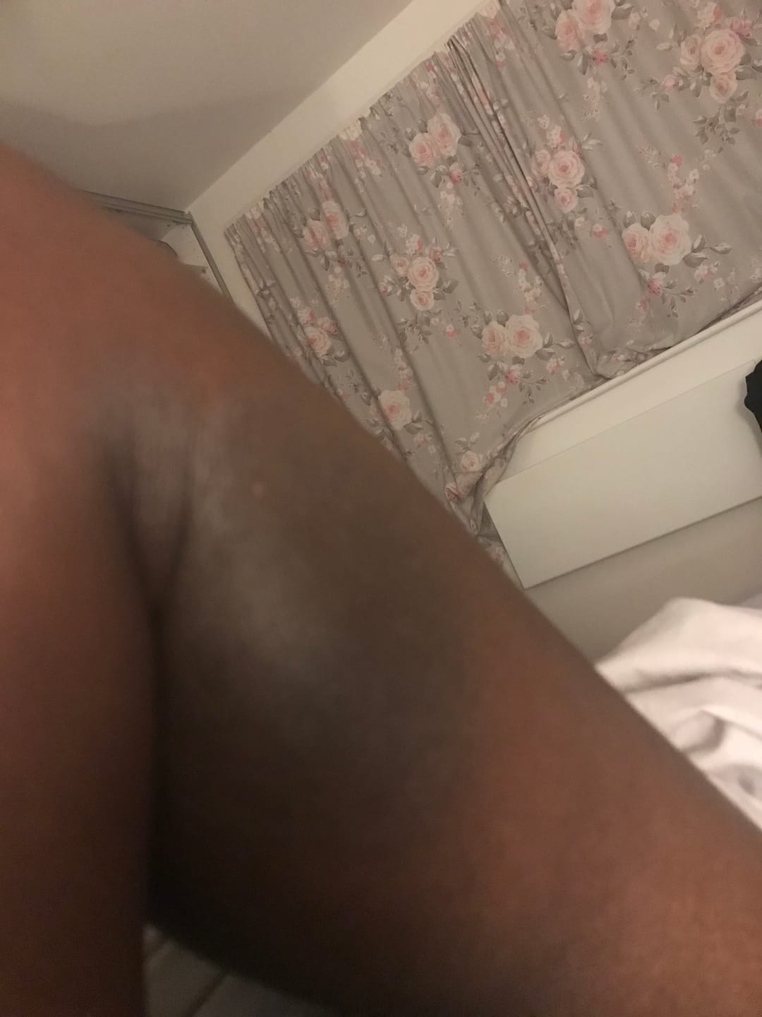 Customer photo review of Magix Cream