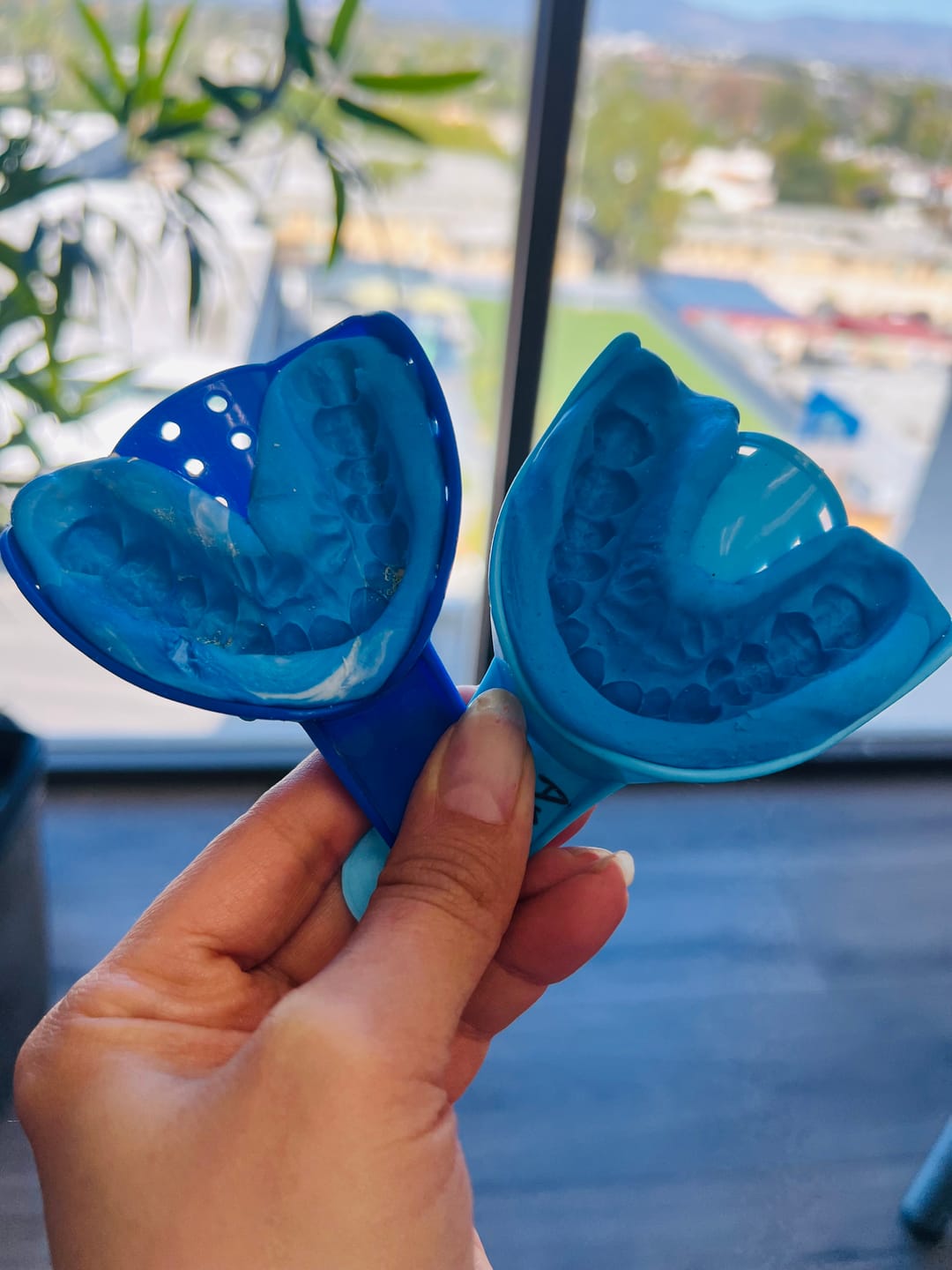 Customer photo review of 2mm Hard Night Guard - Custom Night Guard For Moderate Teeth Grinding/Clenching