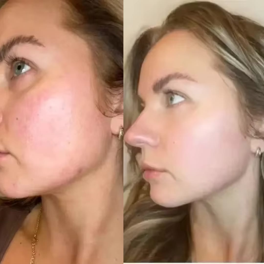 Customer photo review of The Naked Skin™Collagen Jelly Cream