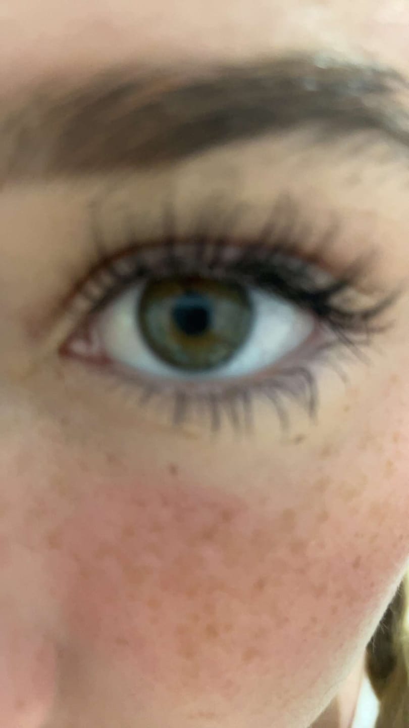 Customer photo review of Eyelash Growth Serum