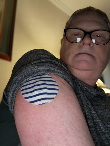 Customer photo review of Skin Grip Original - Dexcom G7 & Stelo Adhesive Patches