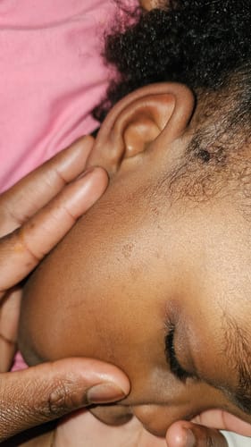 Customer photo review of Anti-Acne & Dark Spots African Soap