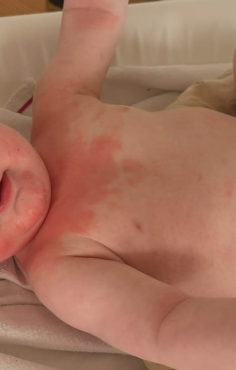 Customer photo review of Eczema Saviour