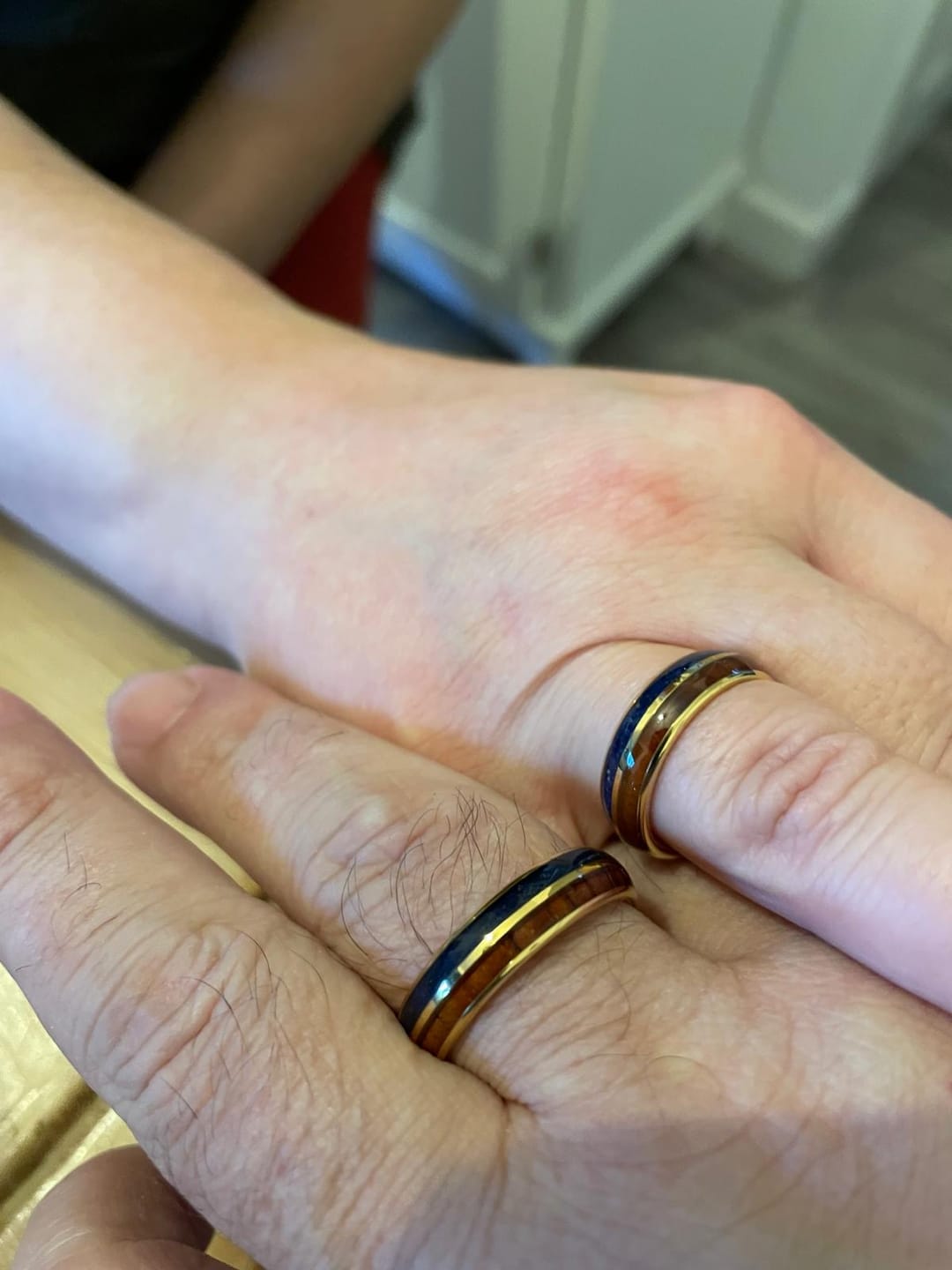 Customer photo review of The Golden Blue Wonder Ring Set