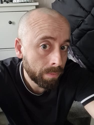 Customer photo review of Trim Pod 2.0 Kit
