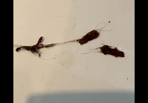 Customer photo review of Paragon | Parasite Cleanse