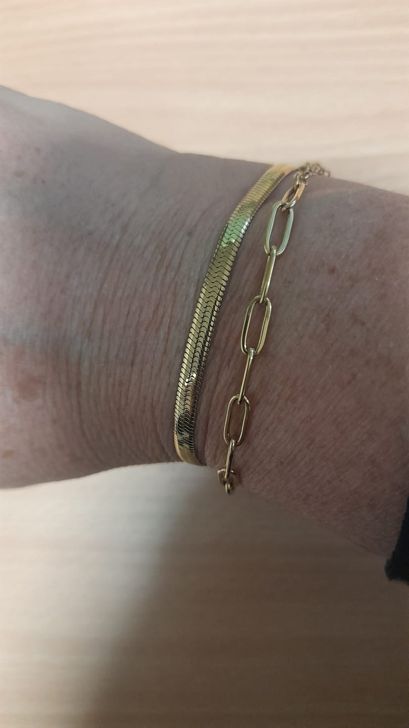 Customer photo review of Essentials Bracelet