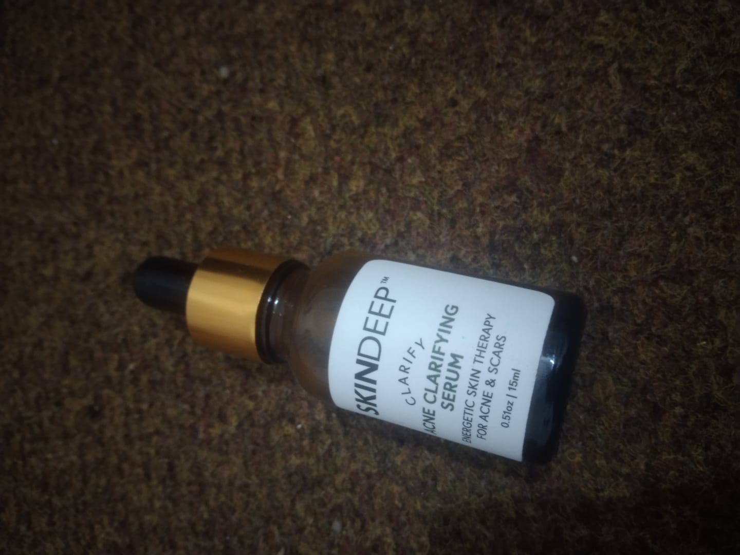 Customer photo review of ACNE CLARIFYING SERUM - Energetic Skin Therapy for Acne & Scars