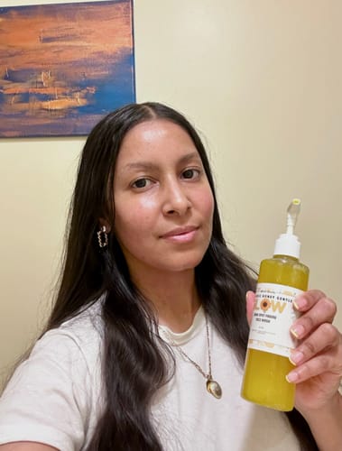 Customer photo review of Acne & dark spot set