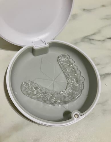 Customer photo review of Upper 1.0mm Essix Retainer
