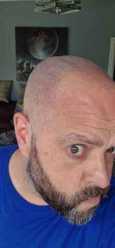 Customer photo review of Trim Pod 2.0 Kit