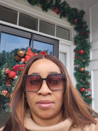 Customer photo review of POWERFUL® Face Whitening Cream