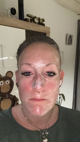 Customer photo review of Bio-Kollagen Gesichtsmaske
