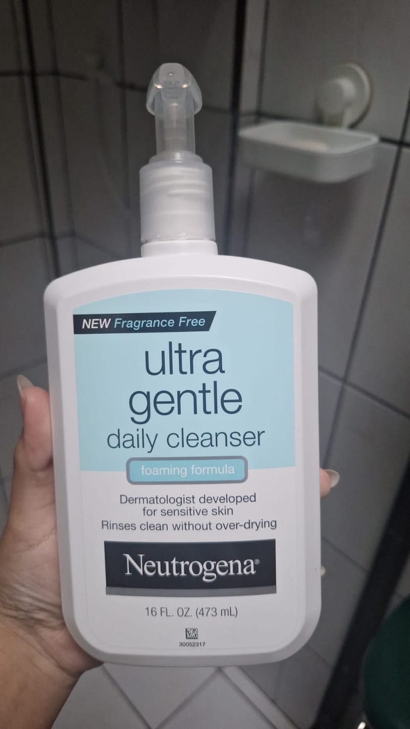 Customer photo review of Ultra Gentle Daily Cleanser