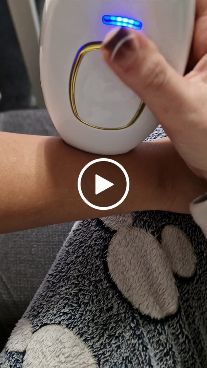 Customer video review of GLIMORA®  - IPL Haarentfernung