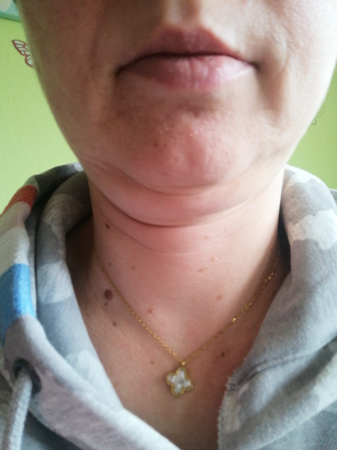 Customer photo review of Perlmutt Black 2in1 Unique Leaf 18K Vergoldet