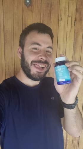 Customer photo review of Vitaminas Hairfy