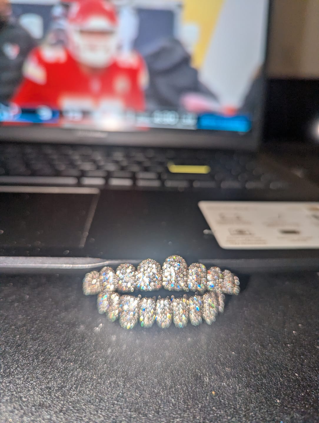 Customer photo review of 18k Gold Diamond Grillz
