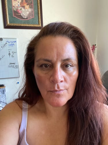 Customer photo review of Glov Micro Infusion System