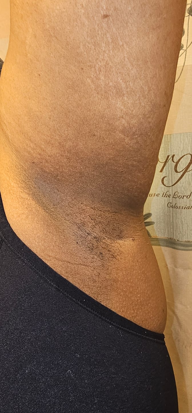 Customer photo review of Brightening Duo