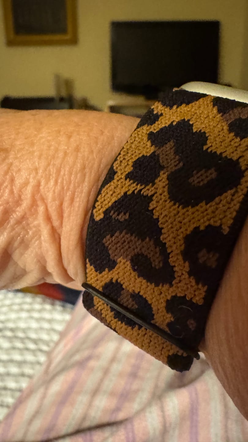 Customer photo review of Roxane Nylon Loop Band