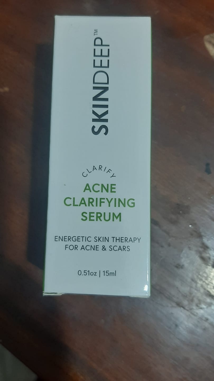 Customer photo review of ACNE CLARIFYING SERUM - Energetic Skin Therapy for Acne & Scars