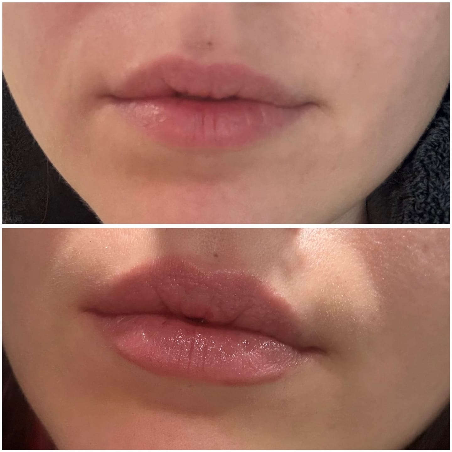Customer photo review of Premium Lippen-Booster