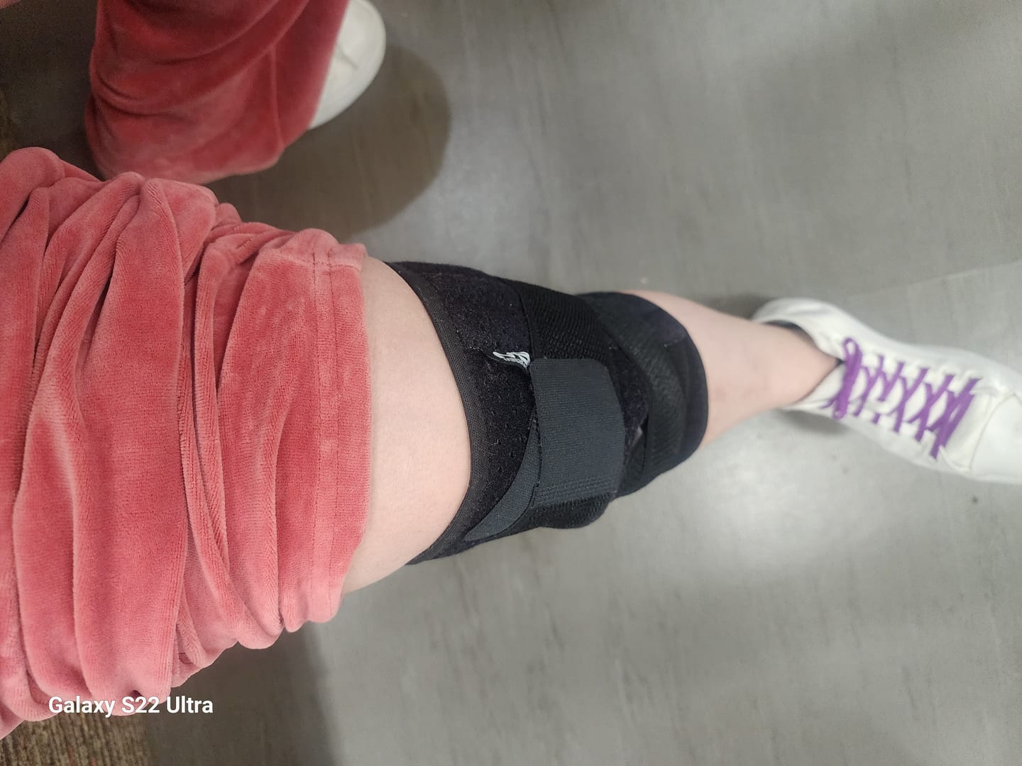 Customer photo review of Knee Support Brace
