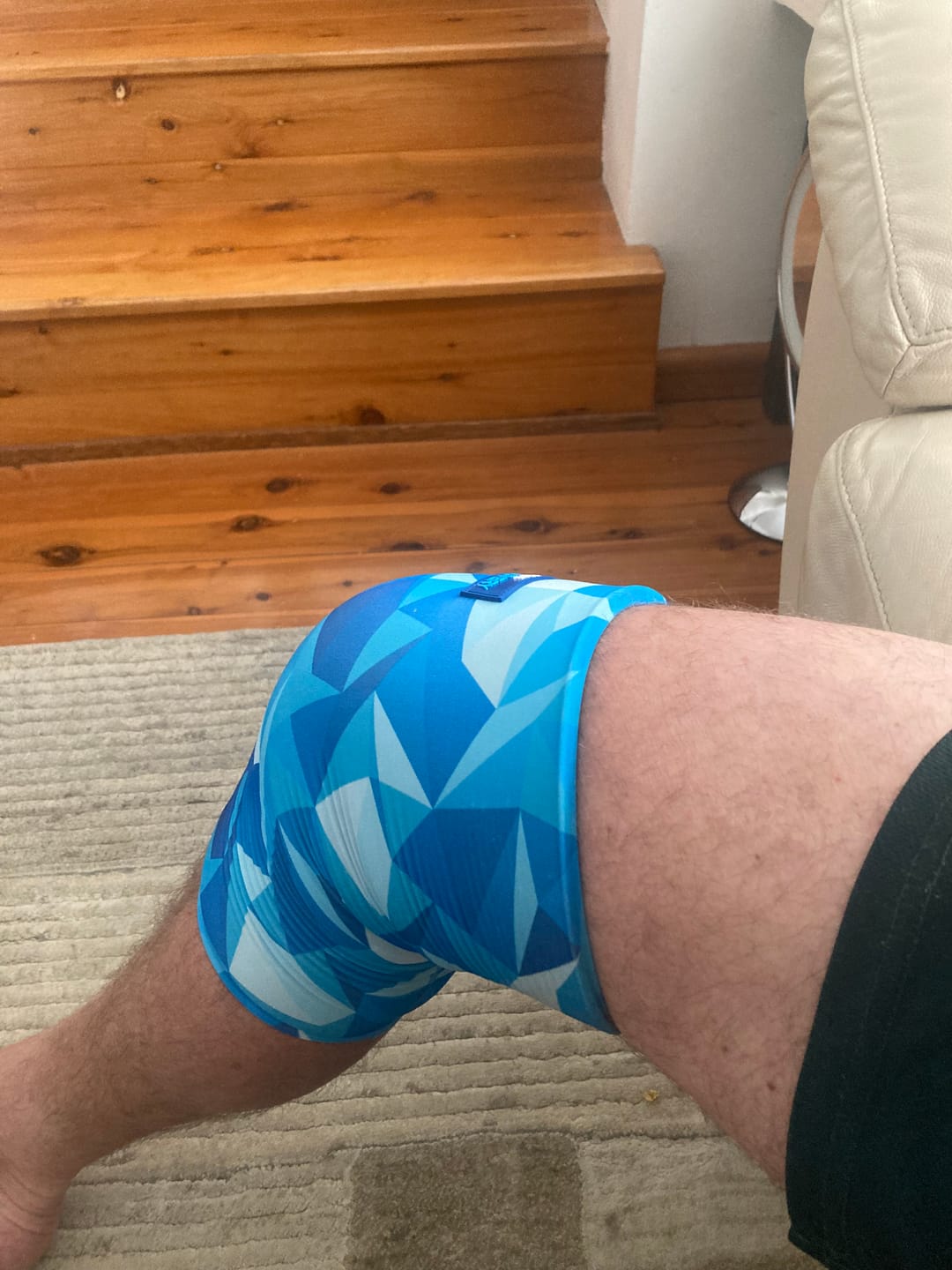 Customer photo review of Medium Hot & Cold Compression Gel Sleeve