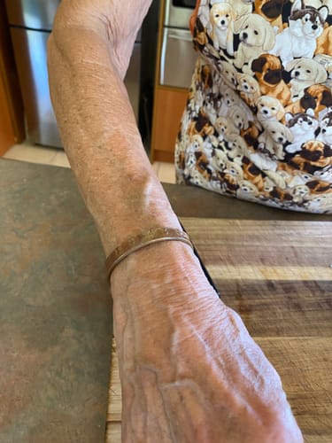 Customer photo review of Kiri / Magnetic / Copper Bracelet