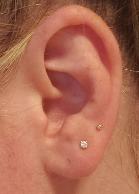 Customer photo review of 14K Gold Internally Threaded Mini Ball Labret Piercing 2mm 2.5mm 3mm 18G16G