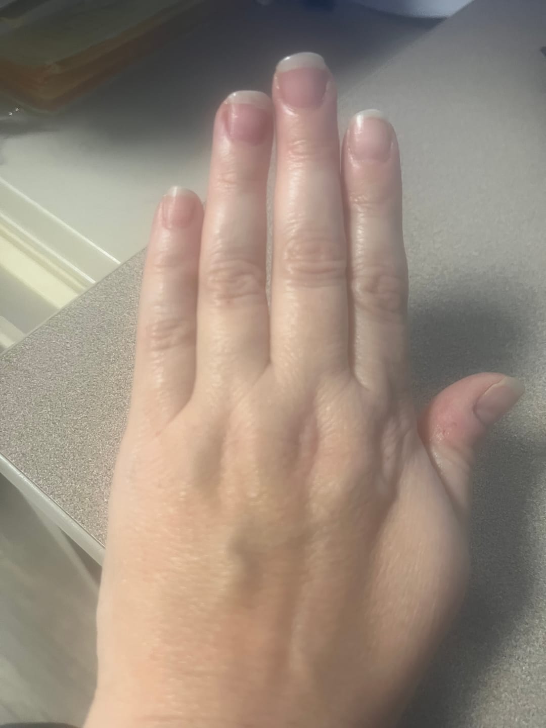 Customer photo review of Whipped Tallow Balm (Tea Tree) - 2 oz