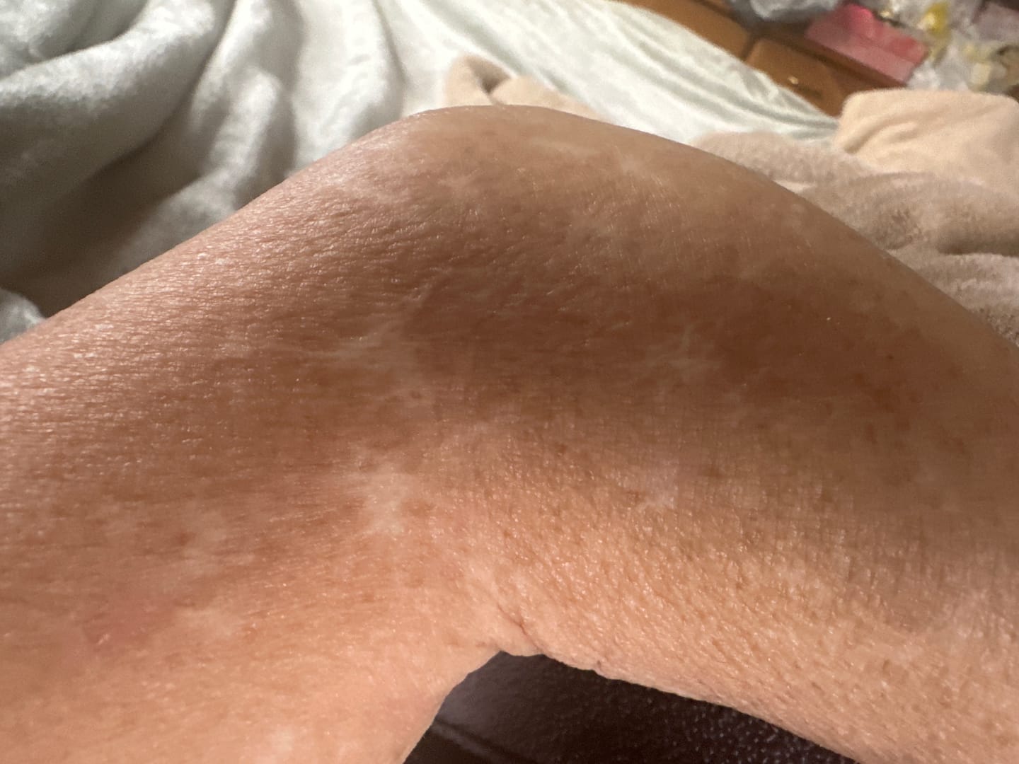 Customer photo review of HoneyBee Venom Elixir Serum
