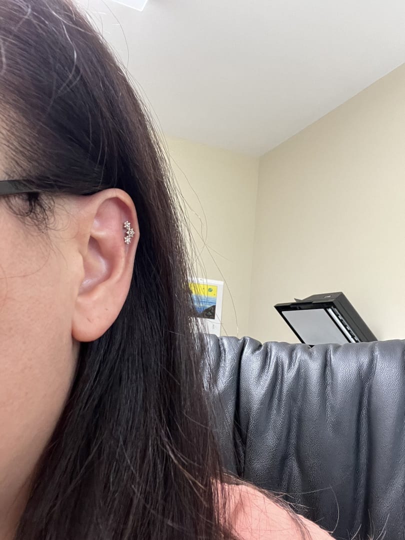 Customer photo review of 14K Gold Internally Threaded Triple Flower Labret Piercing 18G16G