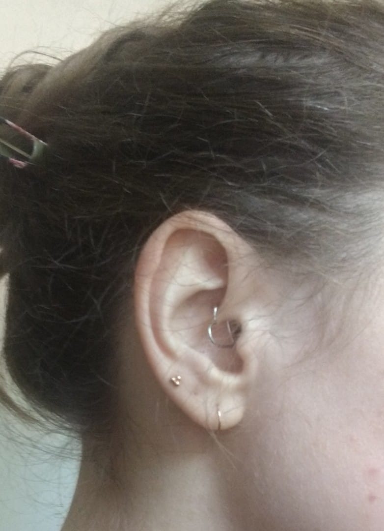 Customer photo review of 14K Gold Internally Threaded Triple Ball Tragus Labret Piercing 18G16G
