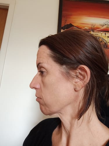 Customer photo review of Skin & Gut Maintain™