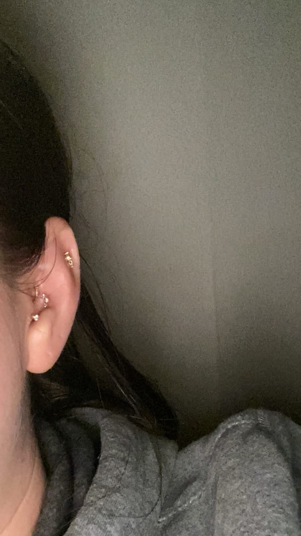 Customer photo review of 14K Gold Internal Cubic Curve Labret Piercing 18G16G