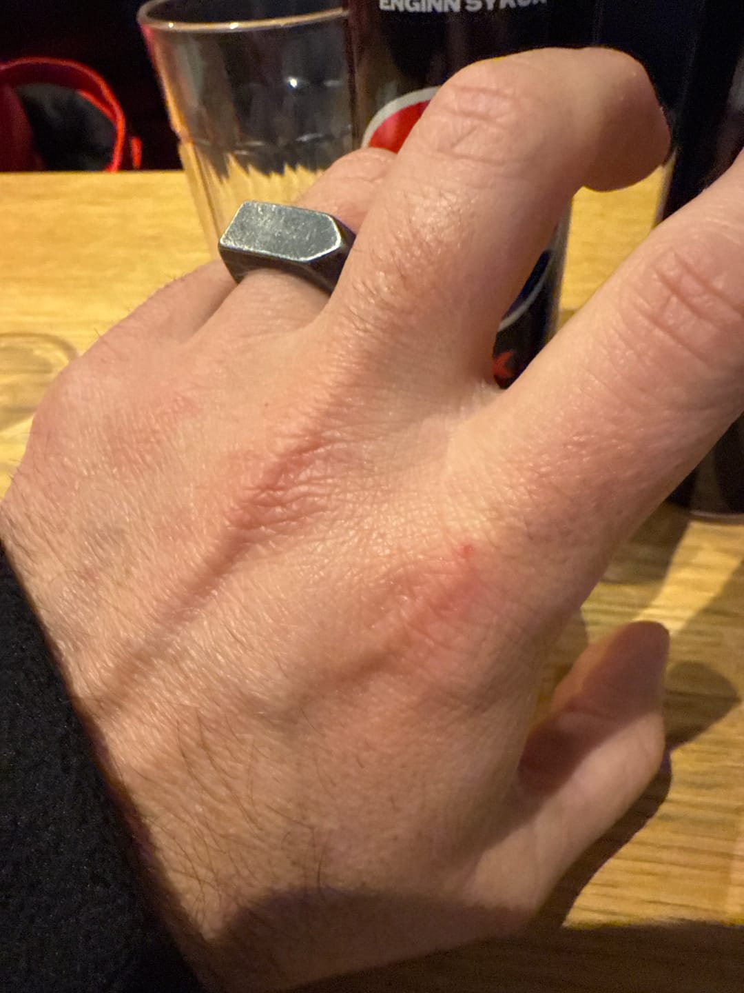 Customer photo review of ARROW. - GRAY