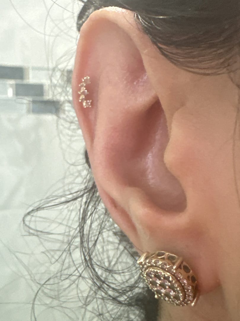 Customer photo review of 14K Gold Internal Cubic Curve Labret Piercing 18G16G