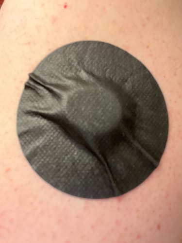 Customer photo review of Skin Grip MAX Dexcom G7 & Stelo Patches - 10 Pack
