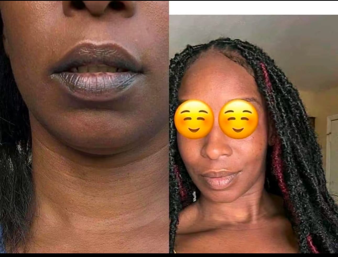 Customer photo review of Pink Lip Kit