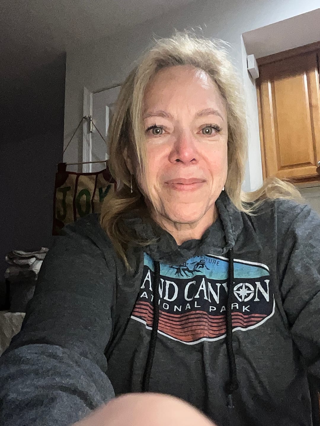 Customer photo review of Himalaya Brown Prescription  Colored Contact Lenses