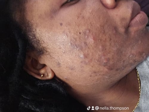 Customer photo review of Micellar Cleanser
