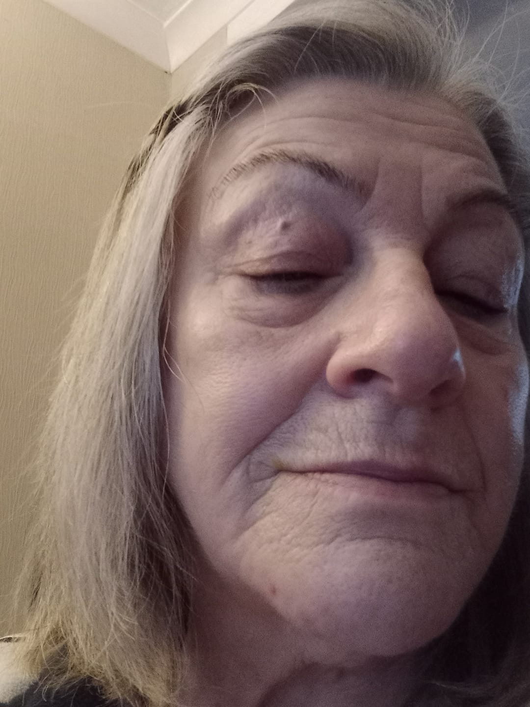 Customer photo review of Mature Skin Cream