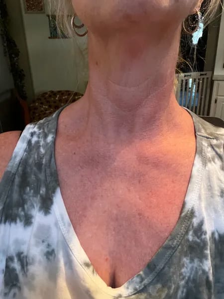 Customer photo review of DermaLifting - masażer ze światłem led do liftingu twarzy i szyi