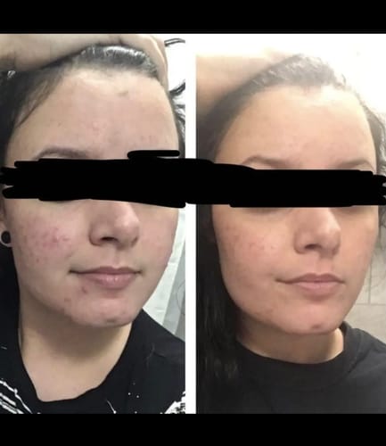 Customer photo review of Turmeric Glow Soap