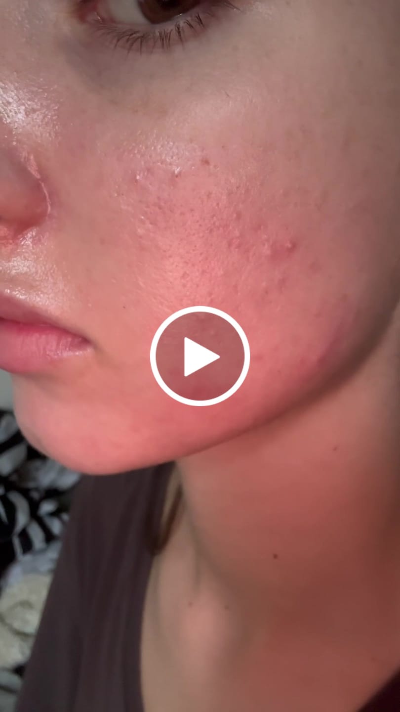 Customer video review of BLACK SOAP - afrikanische schwarze Seife