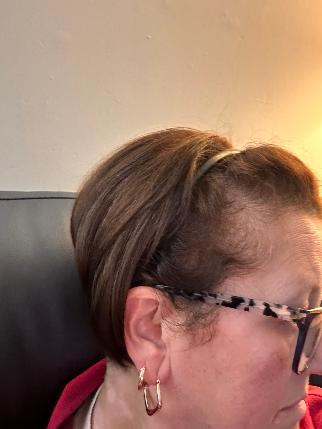 Customer photo review of Complex10™ Hair Growth Supplement