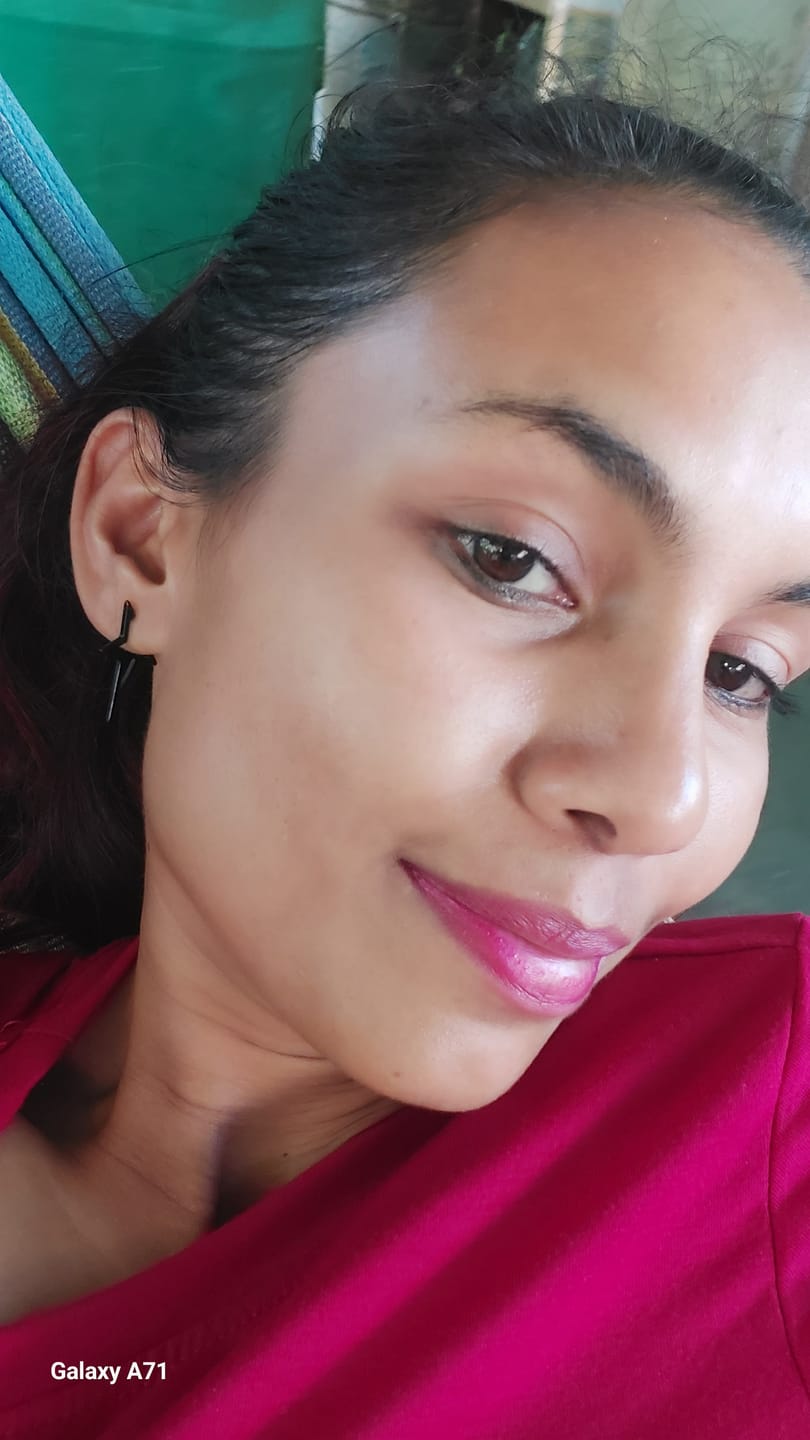 Customer photo review of Neoprosone Vitamin-C Brightening Serum - Fast Absorbing Serum - 30g / 1 Fl Oz