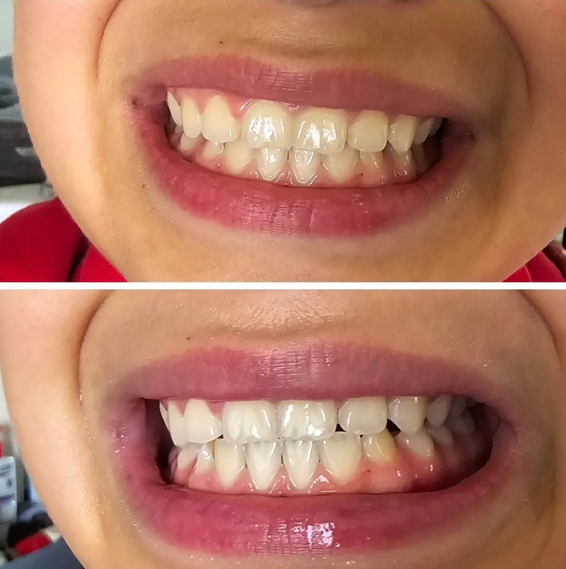 Customer photo review of Whitening & Care Duo
